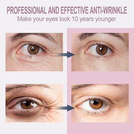 Temporary eye tightening cream, instantly reduces eye bags and dark circles, daily anti-aging, eye cream quickly repairs wrinkles, reduces fine lines, contains hyaluronic acid and retinol, 0.68 oz