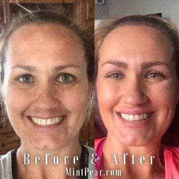 Collagen Peptides Serum 30ml - Anti-Aging Tri-Peptide Firming Serum for Wrinkles & Fine Lines Reduction, Skin Elasticity & Texture Improvement