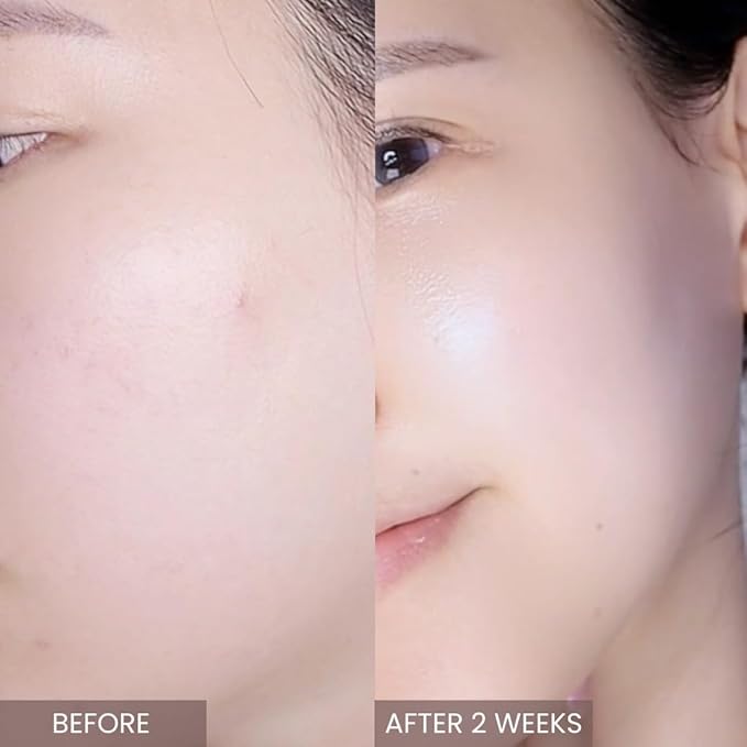 Pink Tea Tree Synergy Serum 30mL/Skin Moisturizer/Facial Moisturizers/1.01 Fl. Oz, CICA, Hyaluronic Acid and Niacinamide, Korean Skin Care, Hydrating