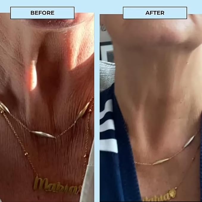 BOOST LAB Edelweiss Neck Firming Serum - Reduce Neck Wrinkles & Neck Ageing - Lifts & Smooths Crepe-Like, Sagging Skin - Paraben Free, Sulphate Free, Fragrance Free - 30 ml (1 fl oz)