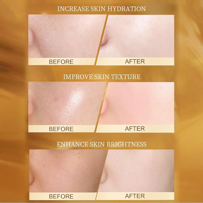 Moisturzing Skincare Sets 9-In-1 Daily Skin Care Routine For Women Mother's Day Gift Valentine's Day Gift Birthday Gift Valentine's Day Gift