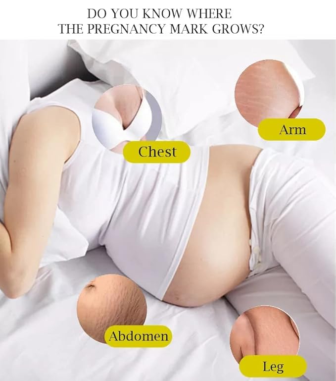 Body Butter | Stretch Marks & Scars by Mother To Mother