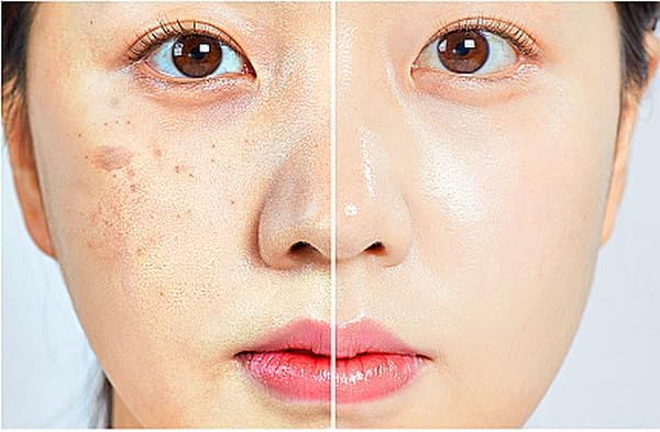 Exceptional Regenerating Serum: Lifts, Volumizes, and Revitalizes with SCM, 5% Volufiline, T1 Collagen, and PHA (30ml, 1oz)