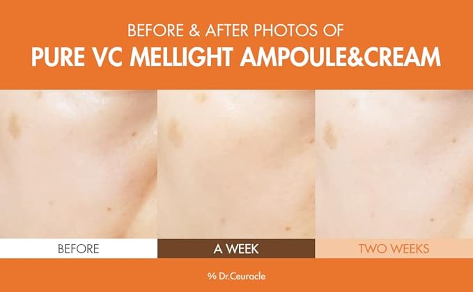 Dr.Ceuracle by leegeehaam Pure VC Mellight Ampoule - Vitamin C Serum for Face, One Week Program for Anti-oxidant, Firm, Clarify, Fade Pigmentation, Skin Radiance (4 Counts (Pack of 1))