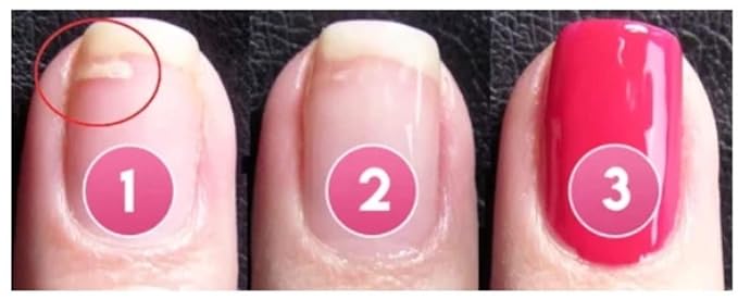 5ml Instant Cracked Nail Repair Gel, Strengthener, Phototherapy Glue - Recovery for Restore Weak, Broken, Damaged Nails - Instantly Fill in and Fix Cracks Flawlessly (1pc)