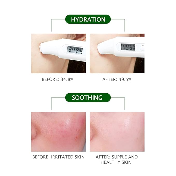 VENZEN Jojoba Oil Simmondsia Chinensis Seed Moisturizing Soothing Nourishment Skin 100 ml