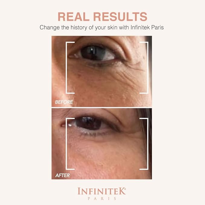 Infinitek Paris Multi-Active Collagen Eye Cream; Retinol Serum Contour - Anti Aging Eye Cream for Wrinkles, Under Eye Treatment for Dark Circles and Under Wrinckle Repair. 0.50 Fl Oz