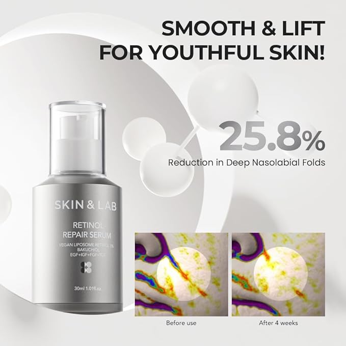[SKIN&LAB] Retinol Repair Serum | Contains Vegan Retinol, Bakuchiol and Peptides| For Reduce Wrinkles & Fine Lines, Smoothing | Daily Facial Essence | For Sensitive Skin Type | 1.01 fl.oz