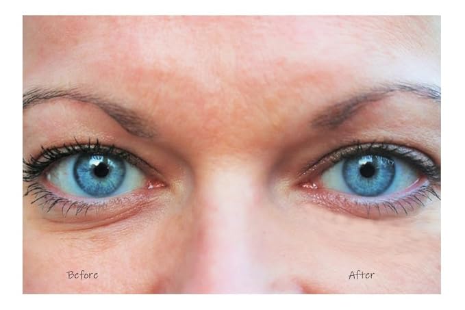 Eye Lift Eye Cream Anti-Wrinkle