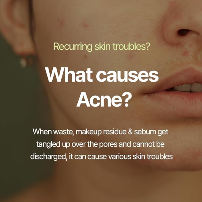 Pyunkang Yul Calming Cleansing Foam, Low pH Formula Facial Wash/Cleanser with Witch Hazel, AHA for oil control- Cica, Tea Tree Extract - Rapid Moisture replenishment 3.38 Fl.oz