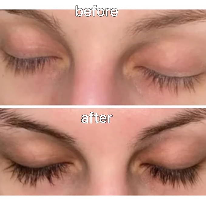 Biotin Lash Serum - Eyelash and Eyebrow Growth Serum for Thicker, Fuller Lashes and Brows, Korean Dermatologist-Developed, 0.35oz