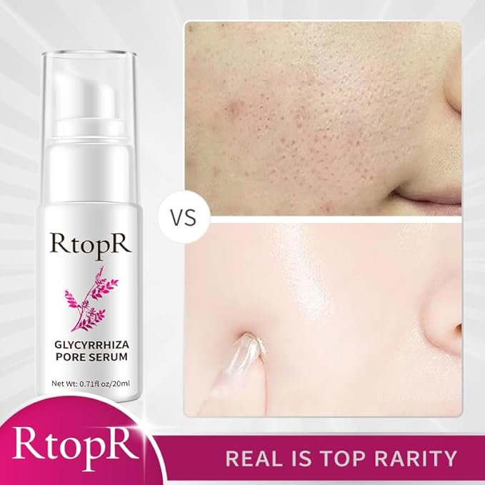 RtopR Glycyrrhiza Pore Soothing Serum