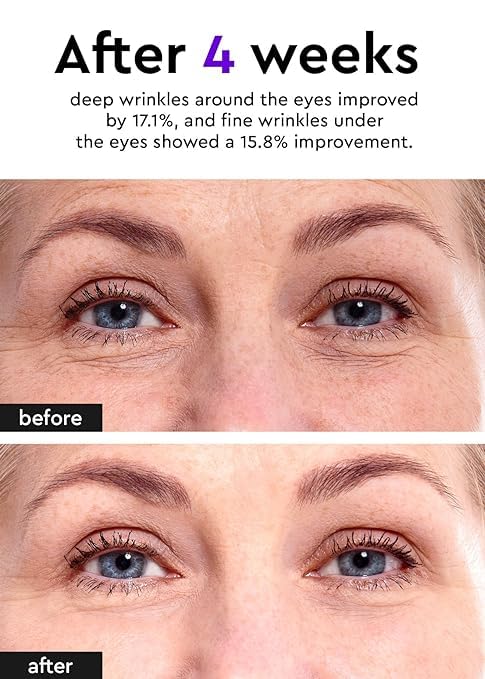 Bewants Under Eye Cream for Puffiness and Bags, Phyto Collagen Firming & Hydrating Treatment – 56.7% Vegan Collagen & Plant-Based Retinol, Refreshing Massage Applicator, 0.67 fl oz (2 Pack)