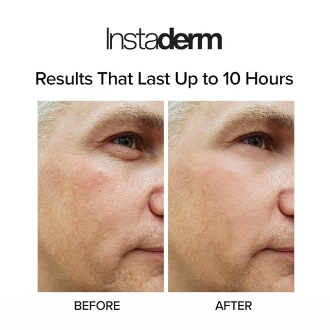 Instant Puffy Eye & Lift Treatment – Removes Under Eye Bags & Puffiness. Eliminate Dark Circles & Wrinkles. Naturally Ageless Hydrating Cream. Disappears Before Your Eyes Within Minutes.