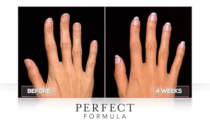 Perfect Formula Daily Moisture Treatment, 0.5 Fl Oz