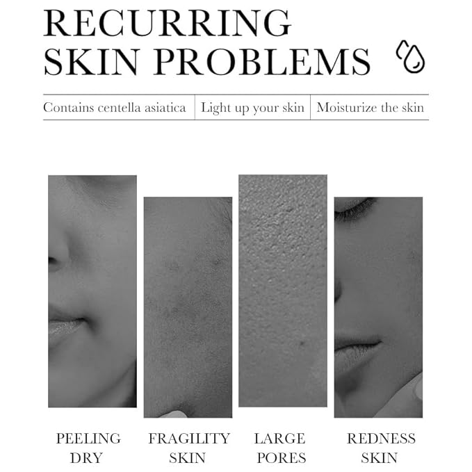 BIOAQUA Centella Asiatica Soothing Repair Facial Serum Nourish Oil Control Anti-Acne Face Skin Care 30ml / 1fl.oz