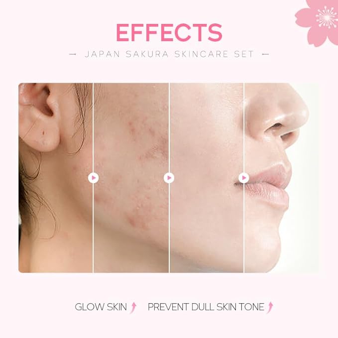 Travel Skincare Set for Women and Teens, Facial Skin Care Gift Set with Vitamin C & Cherry Blossom, Gentle Skin Cleaning & Care Set | Cleanser Toner Serum Eye Cream Face Cream (5PCS)