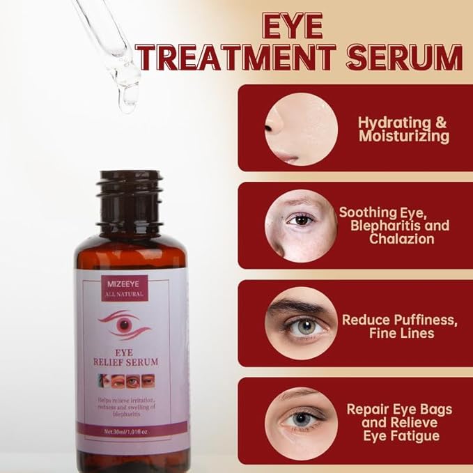 Chalazion Eye Treatment For Blepharitis, 2 PCS Moisturize Eyelids Serum and Chalazion Remover, Gentle Under Eye Relief Serum For Dark Circles, Eye Bags, Puffiness.