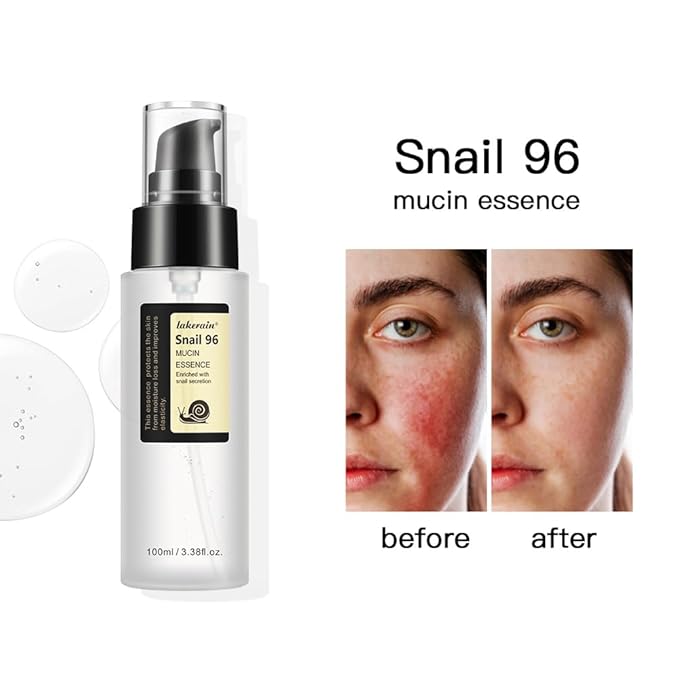 100ML Snail Mucin Serum,Advanced Snail 96 Mucin Power Essence,Snail Mucin Repair Dark Spots,Snail 96,Snail Mucin Essence for Face,Hydration and Moisture,Improve Skin Vitality