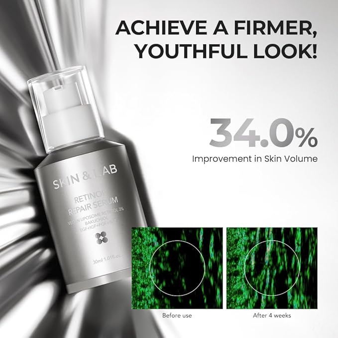 [SKIN&LAB] Retinol Repair Serum | Contains Vegan Retinol, Bakuchiol and Peptides| For Reduce Wrinkles & Fine Lines, Smoothing | Daily Facial Essence | For Sensitive Skin Type | 1.01 fl.oz