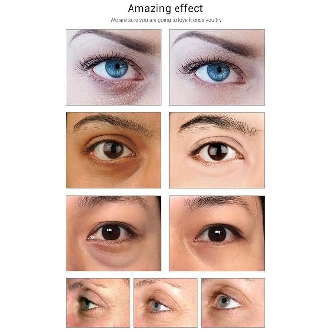 Under Eye Patches- Jakuva 30 Pairs Collagen Eye Masks Eye Patches for Dark Circles and Puffy Eyes, Reduce Wrinkles, Gel Eye Mask Skincare for Moisturizing, Eye Bags Treatment, Pink