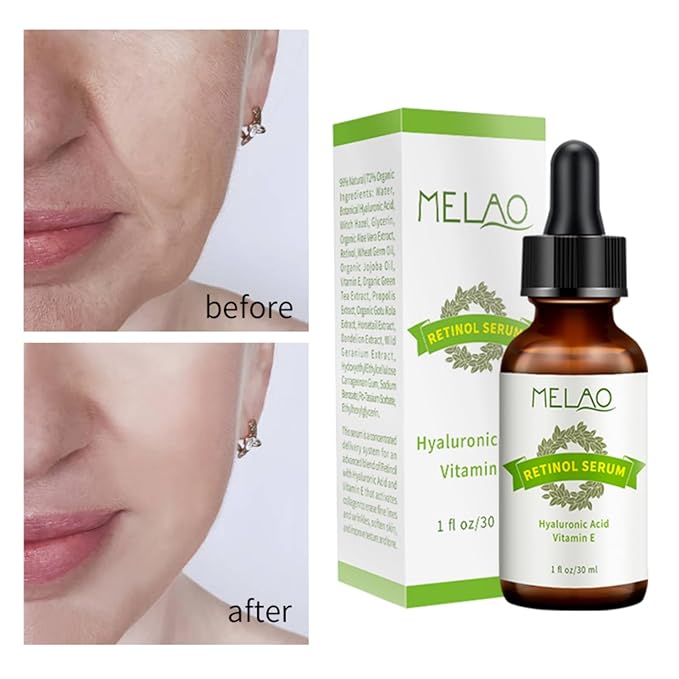 Retinol Serum in Squalane, High-Strength Anti-Aging & Skin Smoothing Formula for All Skin Types - 30ML Per Bottle