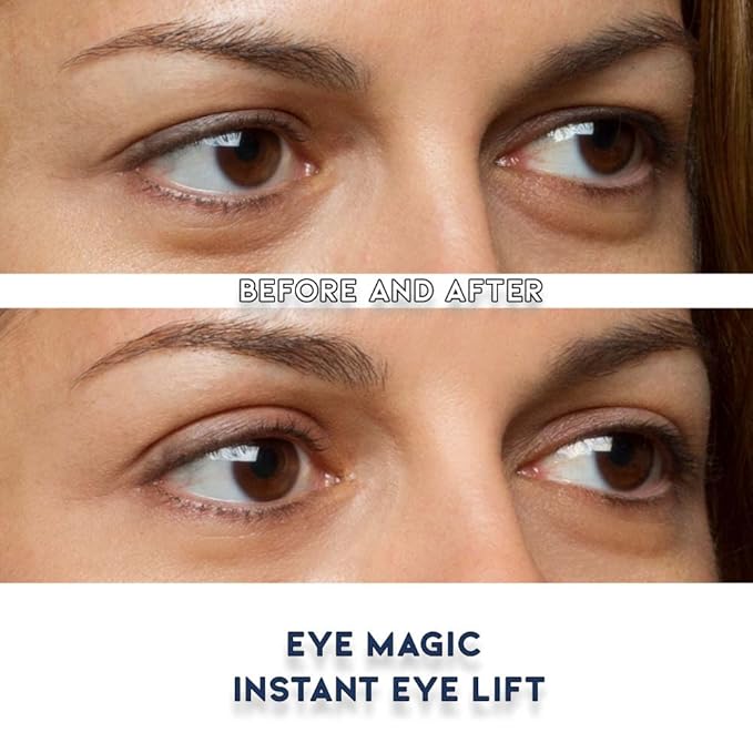 Original Eye Lift Kit (Small/Medium Size With Gel) Lifts Eyelid Droop and Hooded Eyes | Open And Show Off Your Beautiful Eyes | Made In America