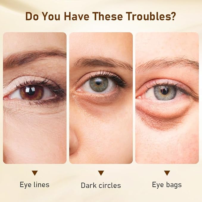 Niacinamide Eye Cream for Dark Circles & Puffiness – Hydrating Under Eye Treatment for Fine Lines & Wrinkles – Firming & Anti-Aging – Sensitive Skin Safe, Fragrance-Free