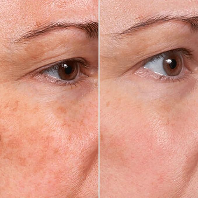 Rejuvenate Face Serum（3pcs），Stock Solution Facial Serum, in a Bottle, Instant Face Lift & Anti Aging Serum for Reduce Wrinkles - Fine Lines-plumping Skin，Hyaluronic Acid Formula for All Skin Types