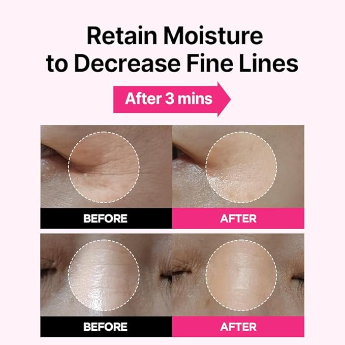 ISOI Blemish Care Eye & Wrinkle Patch, Hyaluronic Acid Eye Masks for Hydration & Firming with Bulgarian Rose Oil, Targeted Care for Fine Lines & Forehead, Korean Skin Care (90pcs, 90g)