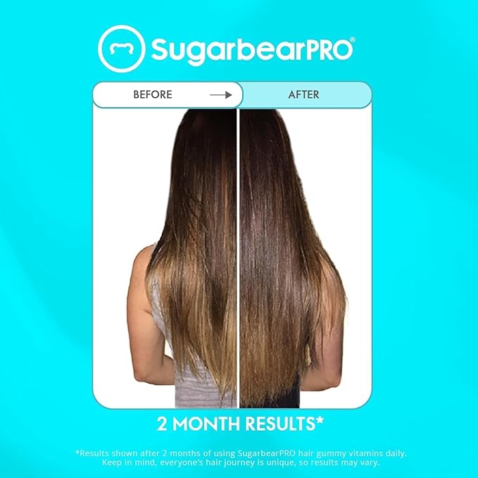 Sugarbear Hair Vitamin Gummy 2 Month Supply & 1 Pure Batana Natural Hair Growth Oil-Extra Strength Biotin 6000mcg, Women, Men, Vegan Vitamin B12, MSM, Inositol, Elderberry, Kosher, Halal, Cruelty-Free