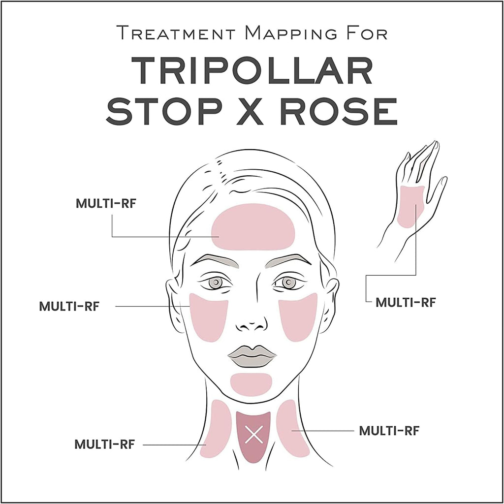 TriPollar Stop X Rose – Radio Frequency Skin Tightening Machine Face & Neck Professional Home RF Anti-Aging Device - Lift Toning Wrinkle Removal Radiofrecuencia Facial Thermal Mapping Algorithm