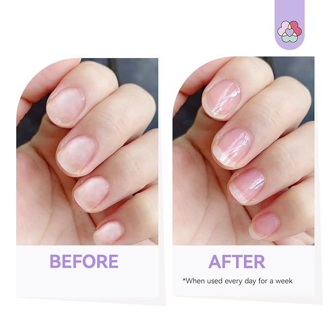 SAVILAND 3-in-1 Nail Strengthener Kit: Ultra Repair Nail Growth and Strengthener with Vitamin E Castor Oil Nail Strengthener for Damaged Nails Care Kit for Repairing Nourishing Weak Brittle Nail Home