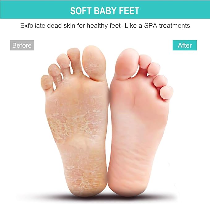 BESKAR XL Large Foot Scrubber Mat for Use in Shower - Shower Foot Cleaner to Eliminate Calluses Dead Skin, Foot Massager Mat for Men & Women to Soothe Achy Feet, Non Slip Suction Cups