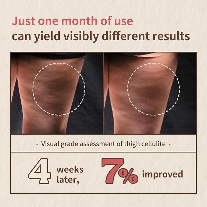 Aroma Nut Slim Fit Body Lotion with 11 Aroma Essential Oils Extract, Anti-Cellutile Lotion, Natural Aroma Scent, Gluten-Free (200ml / 6.76 fl oz.)