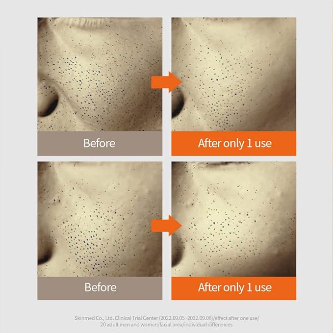 TheYEON Pumpkin Collagen Tension Up Ampoule / 20ml 0.67 fl.oz/Pore care,elasticity,skin nutrition/korean skin care, For Face Moisturization,Smoothening,and Even Tone-Skin Firming Hydrating