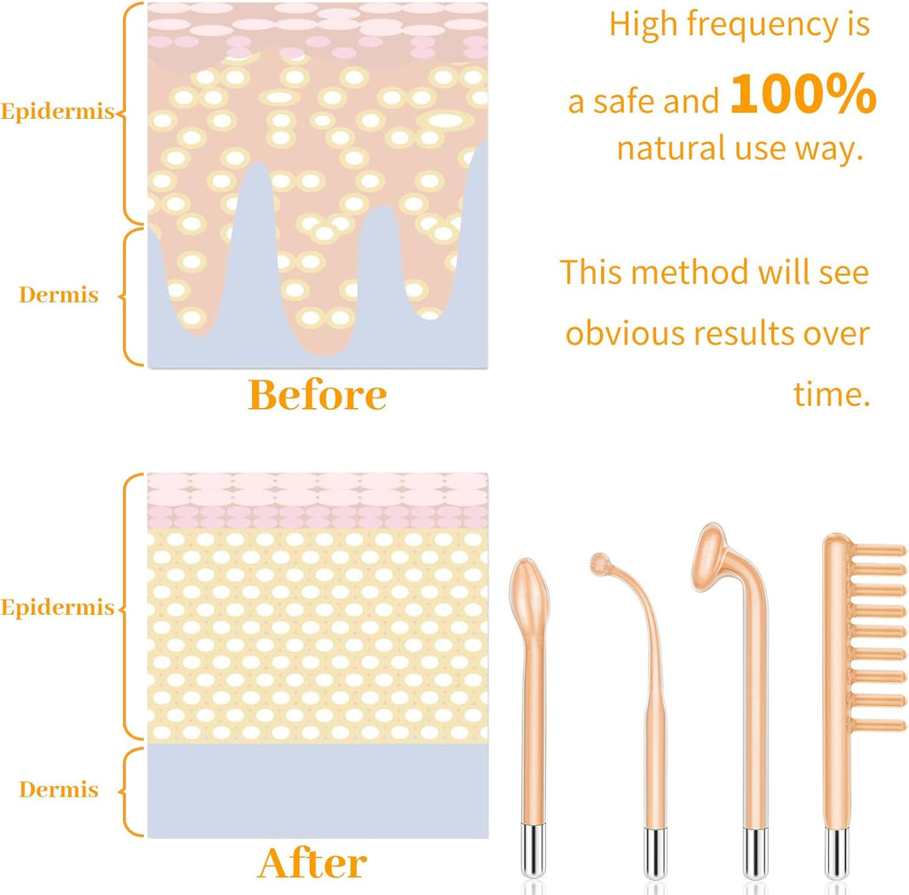 MYSWEETY High F Rrequncy Portable Handheld Facial Skin Care Wand Machine