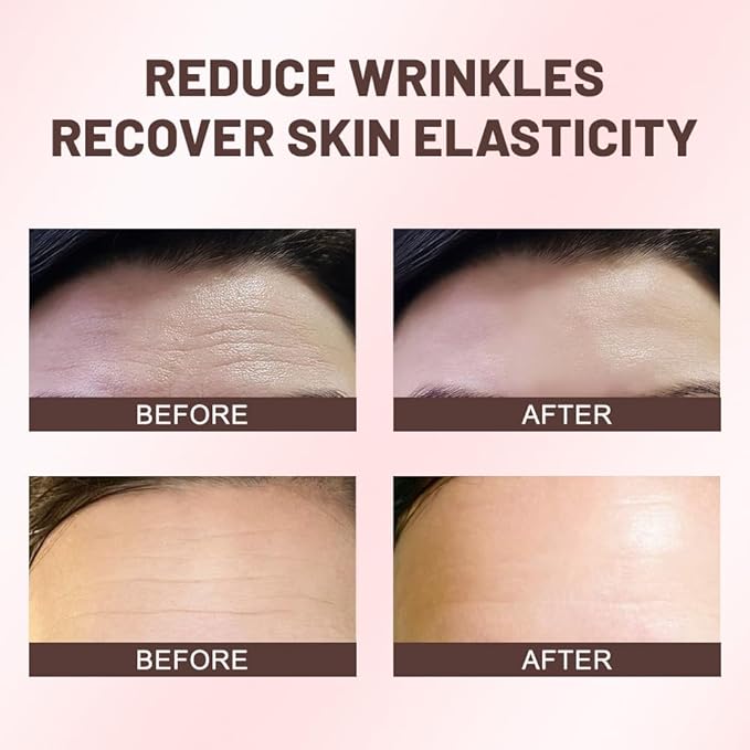 Kaely 20Pcs Forehead Wrinkle Patches,Facial Anti Wrinkle Patches with Collagen,Face Tape for Wrinkles for All Skin Types,Smooth Fine Lines & Wrinkles