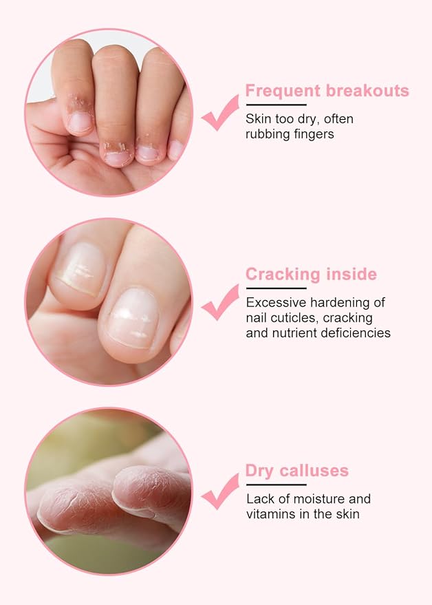 EJW Cuticle Oil for Nails, 1 Week Multi-Functional Care for Hands and Feet, Moisturizes & Strengthens Nails, Improves Hangnails & Dry Skin, Natural Ingredients, Rose