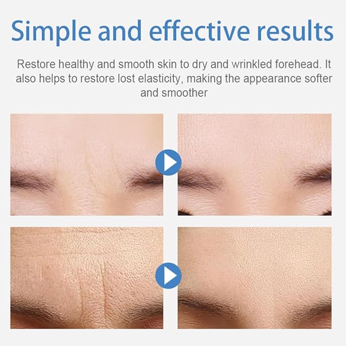 Between the Eyes Wrinkle Patches, Reusable Hydrogel Frown Lines Eleven Lines Facial Patches, Hypoallergenic Silicone Gel Sleep Face Tape, Smooth Fine Lines(frown-18Pcs)