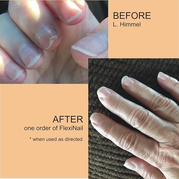 Penetrating Fingernail Conditioner and Strengthener to repair and then maintain weak and peeling or brittle and splitting nails