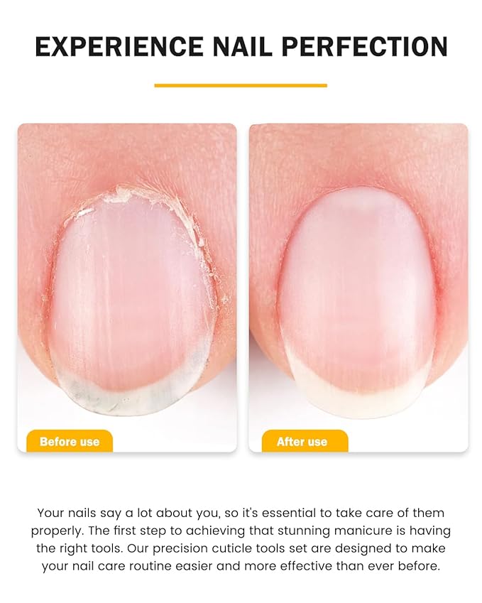 BEZOX Cuticle Trimmer with Pusher - Salon Quality Cuticle Clipper with Cuticle Pushers, Super Sharp Cuticle Cutters and Dual-End Nail Pushers Cuticle Stick, Professional Manicure Tools - Rainbow