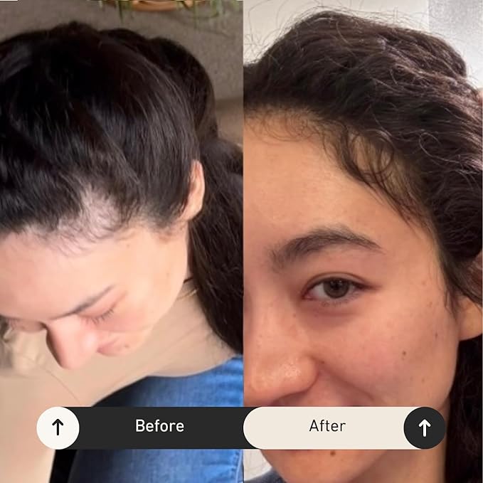 Growing Season Hair Growth And Repair Oil | With Burdock, Nettle Oil and Vitamin C for Visibly Fuller, Stronger and Shinier Hair.