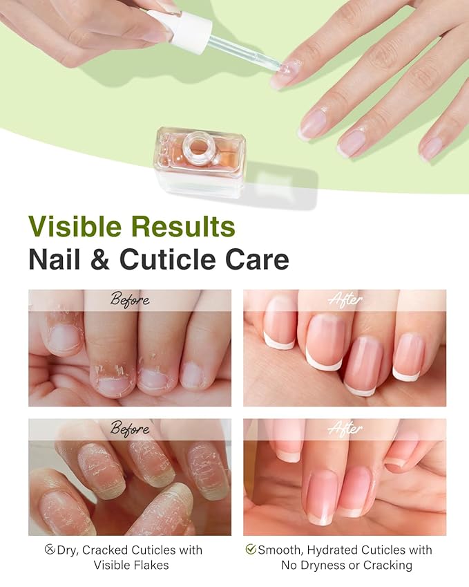 EJW Luxurious Camellia Nail & Cuticle Oil – Infused with Real Flower Extracts, Deeply Hydrating & Strengthening, Nourishing Elegance, Vegan & Paraben-Free – 0.5 fl. oz