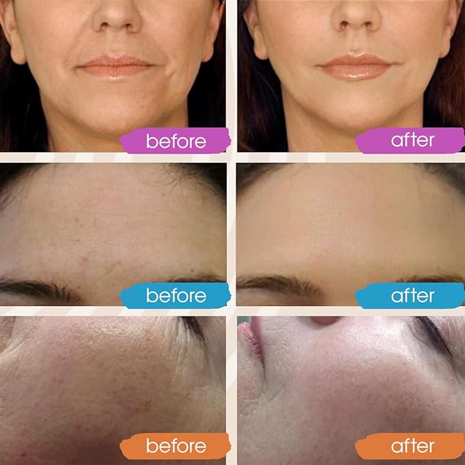 Retinol Serum for Face, Vitamin C with Hyaluronic Acid Face Serum for Women and Men, Glow Skin Care Set Total Package Targets Appearance of Uneven Skin Tone and Dryness 3x2 oz