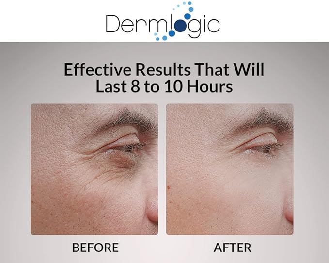 Under Eye Puffiness & Dark Circles Rapid Treatment- Instantly Reduces the Appearance of Puffy Eye Bags, Crow’s Feet, & Sagging Skin.