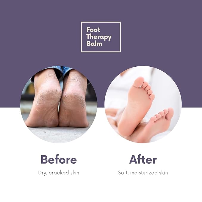 Victoria's Lavender Ultra Rich Foot Balm for Dry Cracked Feet – Cracked Heel Repair & Softener with Tea Tree Oil & Lavender – Dry Heels Treatment for Women & Men – Foot Balm Stick, 2.5 oz, 2-Pack