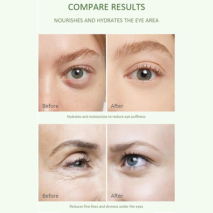 Aloe Vera Eye Serum for Dark Circles,Deeply Moisturizing,Anti Aging, Smooth Fine Lines and Crows Feet,Tightening and Lifts Eye Skin,Enhance Skin Elasticity,Fragrance Free(1 OZ)