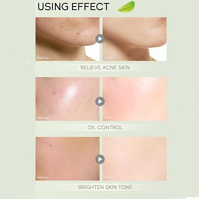 Green Tea Skincare Set, Organic Skin Care Kits Gift Set for Women/Girls, Facial Skincare Routine Kit with Cleanser, Toner, Serum, Cream, Lotion, Eye Cream, Hydrated Skincare Starter Beauty Gift Set