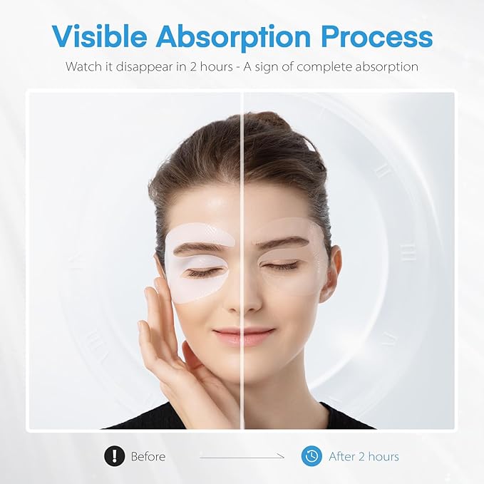 Dongyu Collagen Under Eye Patches: Deep Real Collagen Overnight Eye Gels Mask With Caffeine Peptides Niacinamide - Dark Circles Puffiness Wrinkles Improvement - Neck Smile Line Pads - 8 Pairs